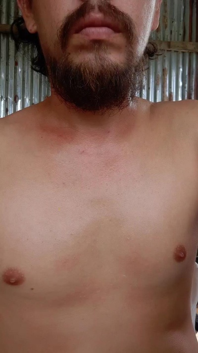 Lars1994 live from Costa Rica